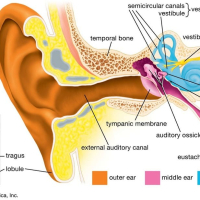 کاهش شنوایی ناشی از بزرگی لوزه سوم